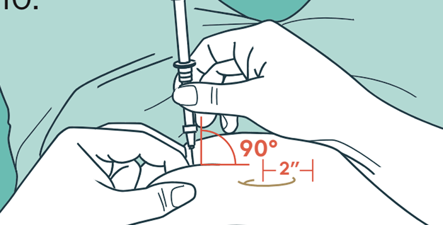 Step-by-step injection instructions for injecting medication