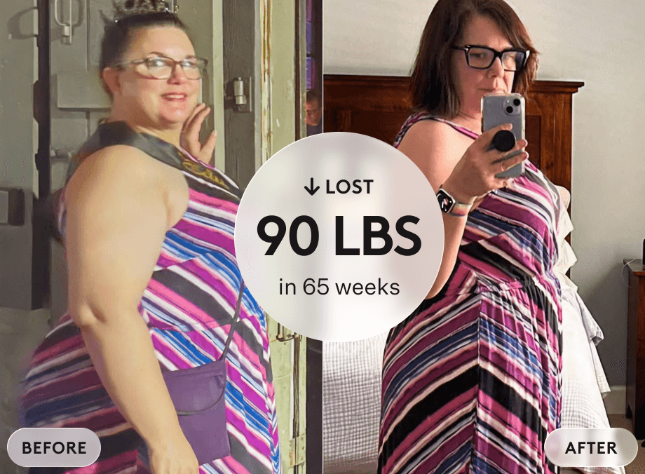 Deborah C. before and after